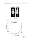 TREATMENT OF METASTATIC BREAST CANCER diagram and image