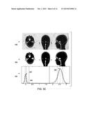 SYSTEMS AND METHODS FOR MAGNETIC RESONANCE BONE DEPICTION diagram and image