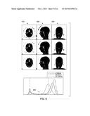 SYSTEMS AND METHODS FOR MAGNETIC RESONANCE BONE DEPICTION diagram and image