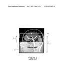 PSEUDO-CONTINUOUS ASYMMETRIC SIGNAL TARGETING ALTERNATING RADIO FREQUENCY     (pASTAR) FOR MAGNETIC RESONANCE ANGIOGRAPHY diagram and image