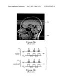 PSEUDO-CONTINUOUS ASYMMETRIC SIGNAL TARGETING ALTERNATING RADIO FREQUENCY     (pASTAR) FOR MAGNETIC RESONANCE ANGIOGRAPHY diagram and image