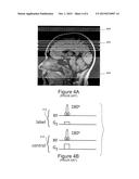 PSEUDO-CONTINUOUS ASYMMETRIC SIGNAL TARGETING ALTERNATING RADIO FREQUENCY     (pASTAR) FOR MAGNETIC RESONANCE ANGIOGRAPHY diagram and image