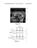 PSEUDO-CONTINUOUS ASYMMETRIC SIGNAL TARGETING ALTERNATING RADIO FREQUENCY     (pASTAR) FOR MAGNETIC RESONANCE ANGIOGRAPHY diagram and image