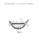 SOLAR ARRAY SUPPORT METHODS AND SYSTEMS diagram and image