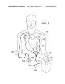 MEDICAL DEVICE PLACEMENT SYSTEM AND A METHOD FOR ITS USE diagram and image