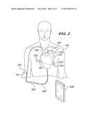 MEDICAL DEVICE PLACEMENT SYSTEM AND A METHOD FOR ITS USE diagram and image