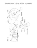 COLLECTING AND HARVESTING CUT BONE FROM KERRISON RONGEUR diagram and image