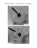 COLLECTING AND HARVESTING CUT BONE FROM KERRISON RONGEUR diagram and image