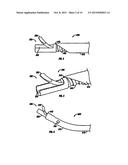 SURGICAL DISC REMOVAL TOOL diagram and image