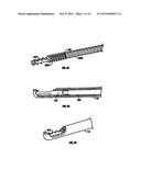 SURGICAL DISC REMOVAL TOOL diagram and image