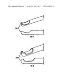 SURGICAL DISC REMOVAL TOOL diagram and image