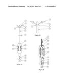 Methods and Devices for Conduit Occlusion diagram and image