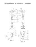 Methods and Devices for Conduit Occlusion diagram and image