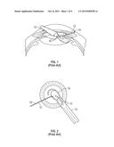 INTRAOCULAR LENS INSERTER diagram and image