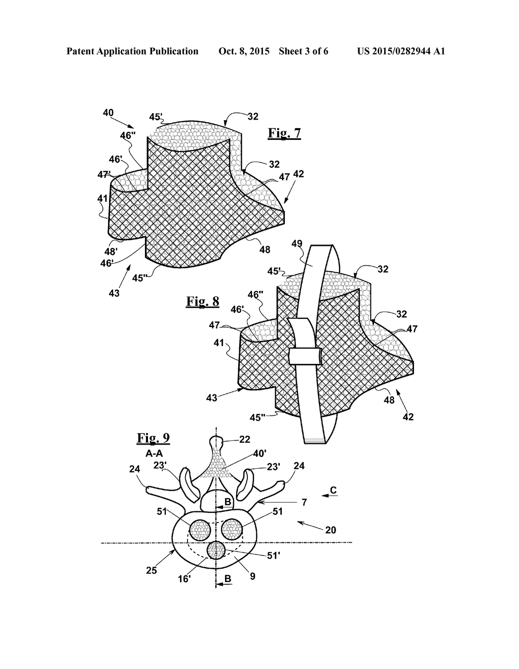 VERTEBRAL FUSION DEVICE AND SYSTEM - diagram, schematic, and image 04