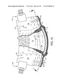 ABSORBENT ARTICLE diagram and image