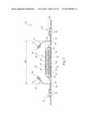 Absorbent Articles Having Zones diagram and image