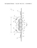 Absorbent Articles Having Zones diagram and image