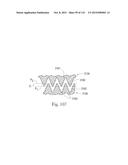 Absorbent Articles Having Zones diagram and image