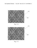 Absorbent Articles Having Zones diagram and image