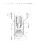 Absorbent Articles Having Zones diagram and image