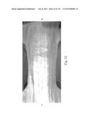 Absorbent Articles Having Zones diagram and image