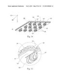 Absorbent Articles Having Zones diagram and image