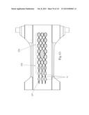 Absorbent Articles Having Zones diagram and image