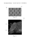 Absorbent Articles Having Zones diagram and image