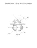 Absorbent Articles Having Zones diagram and image