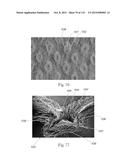 Absorbent Articles Having Zones diagram and image