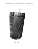 Absorbent Articles Having Zones diagram and image