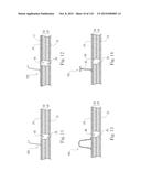 Absorbent Articles Having Zones diagram and image