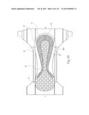 Absorbent Articles Having Zones diagram and image