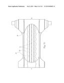 Absorbent Articles Having Zones diagram and image