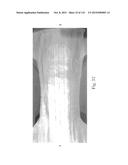 Absorbent Articles Having Zones diagram and image