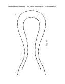 Absorbent Articles Having Zones diagram and image