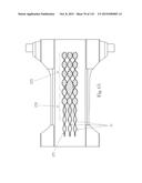 Absorbent Articles Having Zones diagram and image