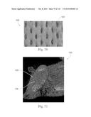 Absorbent Articles Having Zones diagram and image