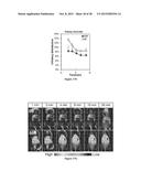 POLYMERIC NANOPARTICLES diagram and image