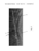 ELECTROPORATION APPARATUSES AND THEIR METHOD OF USE diagram and image