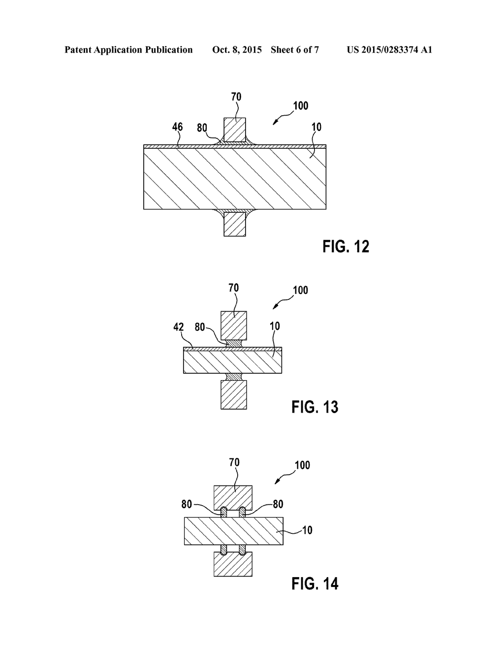 Electric Feedthrough For Electromedical Implants, Electric Contact Element     Comprising Such A Feedthrough, And Electromedical Implant - diagram, schematic, and image 07