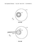 ROTATABLE TARGETING MAGNET APPARATUS AND METHOD OF USE THEREOF IN     CONJUNCTION WITH A CHARGED PARTICLE CANCER THERAPY SYSTEM diagram and image