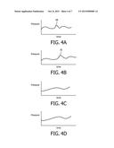 AUTOMATIC PAIRING OF WIRELESS PERIPHERALS IN A SYSTEM SUCH AS PRESSURE     SUPPORT RESPIRATORY THERAPY SYSTEM diagram and image