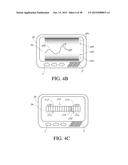 SYSTEMS AND METHODS FOR REPLACING SIGNAL ARTIFACTS IN A GLUCOSE SENSOR     DATA STREAM diagram and image