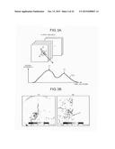 X-RAY DIAGNOSTIC APPARATUS AND IMAGE PROCESSING APPARATUS diagram and image