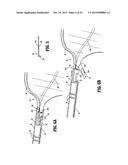 SPECIMEN RETRIEVAL DEVICE WITH POUCH STOP diagram and image