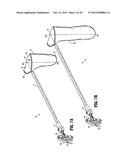 SPECIMEN RETRIEVAL DEVICE WITH POUCH STOP diagram and image