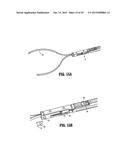 SPECIMEN RETRIEVAL DEVICE WITH POUCH STOP diagram and image