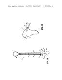 SPECIMEN RETRIEVAL DEVICE WITH POUCH STOP diagram and image